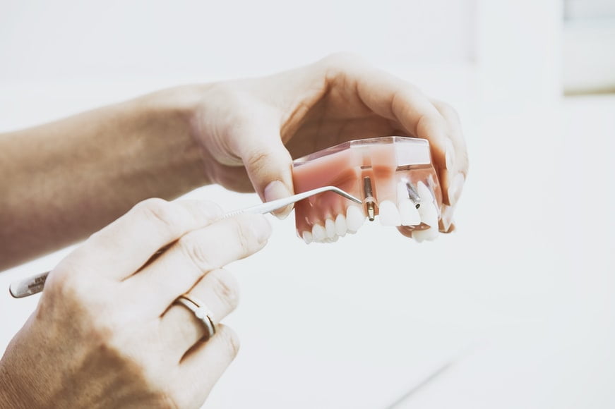 Signs of Suffering that Can be Healed By dental implants in Houston