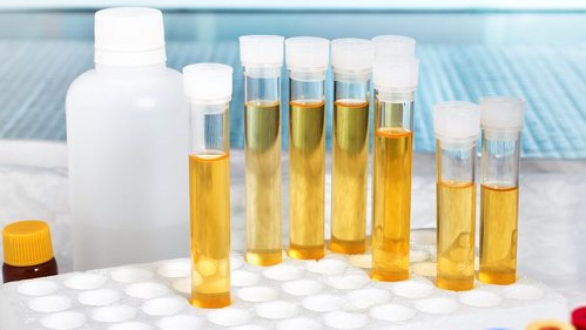Synthetic Urine