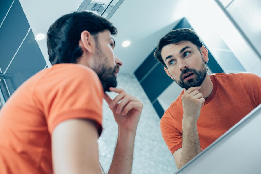Why Do People Get Beard Transplants?