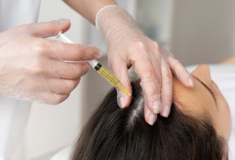 Hair's Vitality in London: The Tailored Benefits Of PRP Treatment