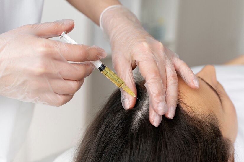 Hair's Vitality in London: The Tailored Benefits Of PRP Treatment